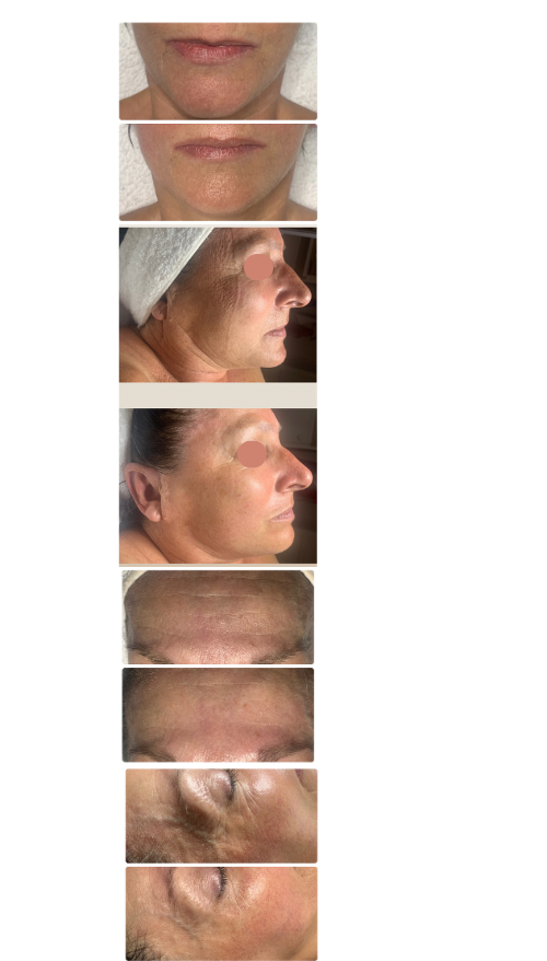 MAISON MO - Issoire - MASSAGE FACIALISTE MASSAGE FACIALISTE SUR MESURE